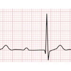 132: Treatment of calcium channel blocker overdose in adult patients